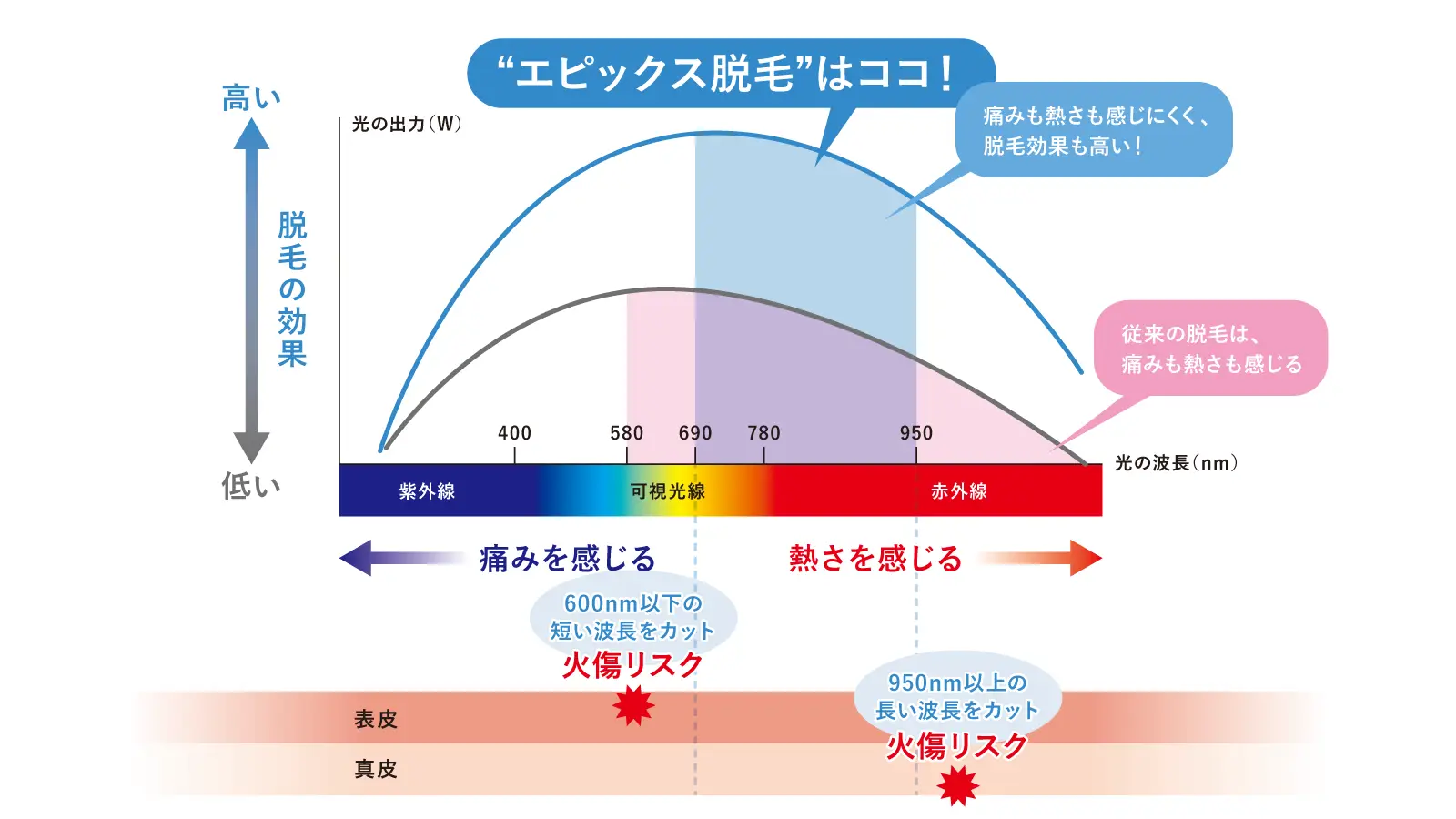エピックス脱毛の特徴
